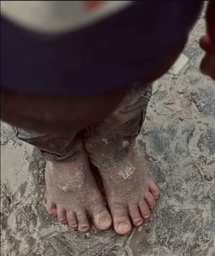 Abu Amir 24 2 25 pieds nus enfant Témoignage d'Abu Amir, le 24 février 2025 –  Le récit d’une femme, dans le vent de la douleur