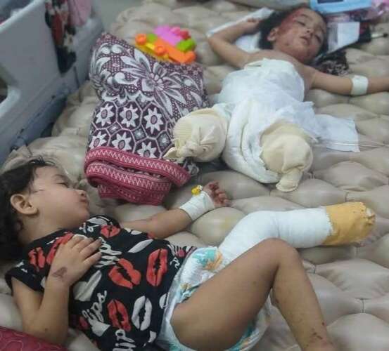 Enfants mutiles Gaza 2025 Témoignage d'Abu Amir, le 3 avril 2025 – Gaza saigne… et le monde regarde.