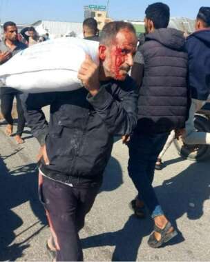 Abu Amir 28 5 25 homme blesse IMG 2484 Témoignage d'Abu Amir, le 28 mai 2025 – La famine à Gaza, une arme de mort impitoyable