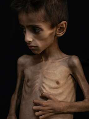 starving kid Témoignage d'Abu Amir, le 2 juin 2025 (1) –  Assez de silence, sauvons ce qu’il reste de notre humanité, sauvons Gaza avant qu’il ne soit trop tard !